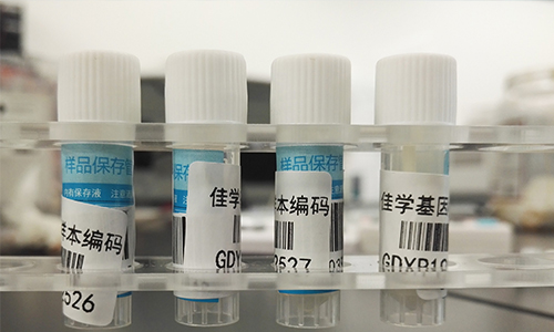 【佳學基因檢測】做Bosch-Boonstra-Schaaf視神經萎縮綜合征基因解碼、<a href=http://sushiinoueharlem.com/tk/jiema/cexujishu/2021/31933.html>基因檢測</a>需要多長時間？