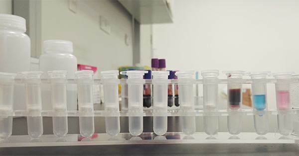 【佳學(xué)基因檢測(cè)】Brown-Vialetto-VanLaere綜合征2型基因解碼、<a href=http://sushiinoueharlem.com/tk/jiema/cexujishu/2021/31933.html>基因檢測(cè)</a>報(bào)告看得懂嗎？