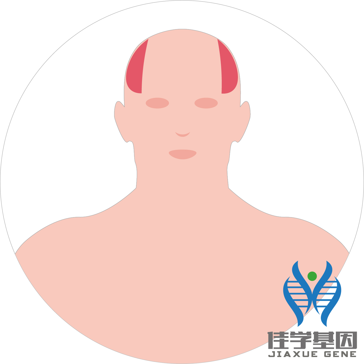 【佳學(xué)基因檢測】男性<font color='red'>脫發(fā)</font>（Androgenetic alopecia）基因解碼、<a href=http://sushiinoueharlem.com/tk/jiema/cexujishu/2021/31933.html>基因檢測</a>