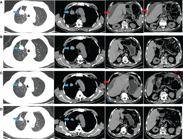 An external file that holds a picture, illustration, etc.
Object name is fonc-12-995624-g001.jpg