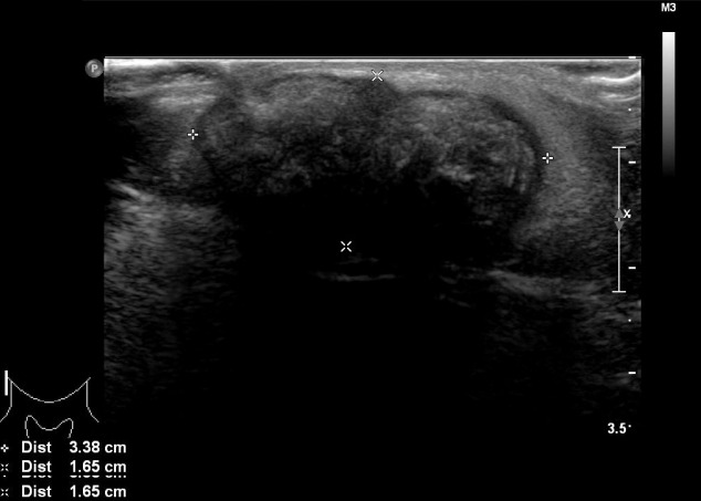 An external file that holds a picture, illustration, etc.
Object name is acfs-2019-00710f2.jpg