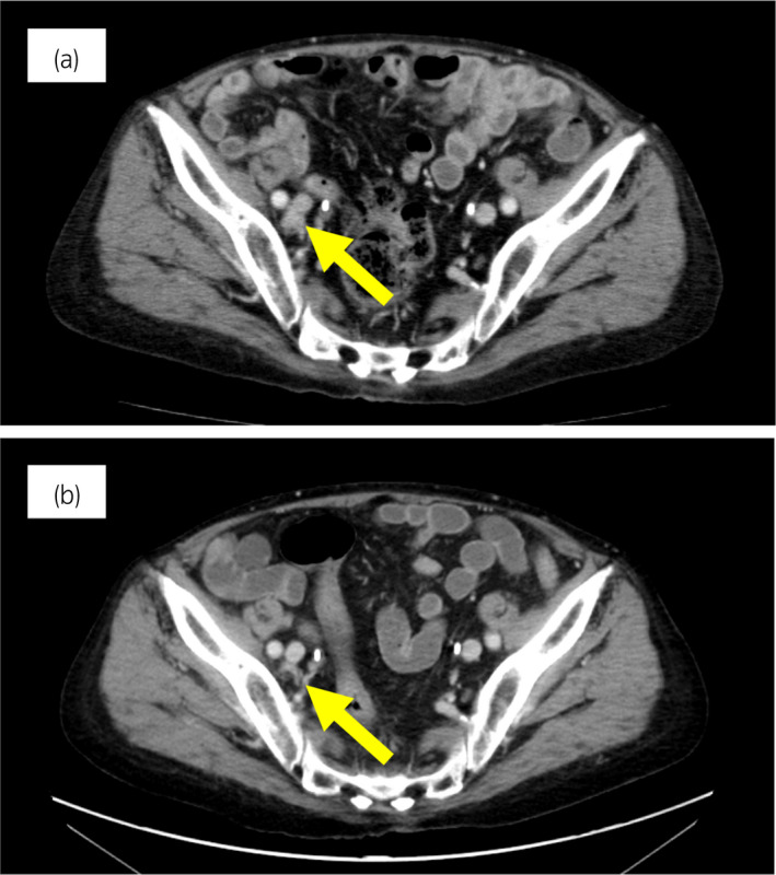An external file that holds a picture, illustration, etc.
Object name is IJU5-6-37-g001.jpg
