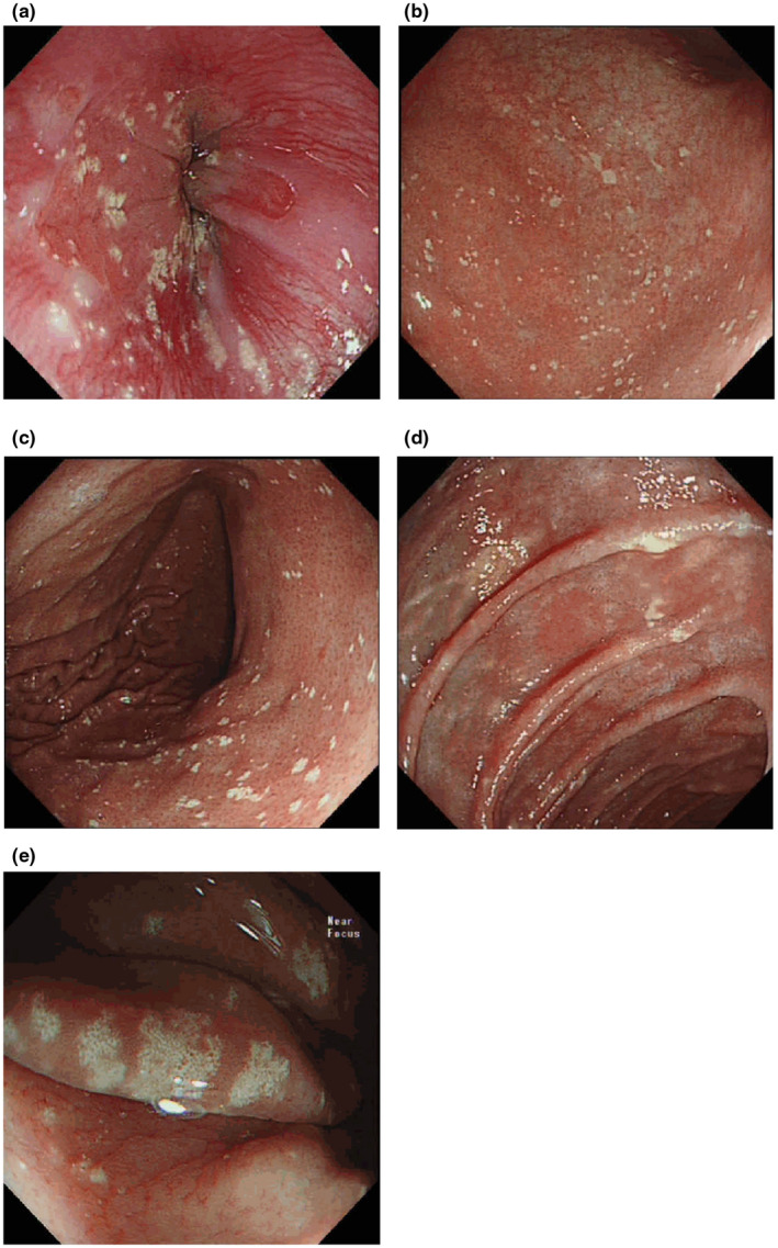 An external file that holds a picture, illustration, etc.
Object name is MGG3-10-e1848-g004.jpg